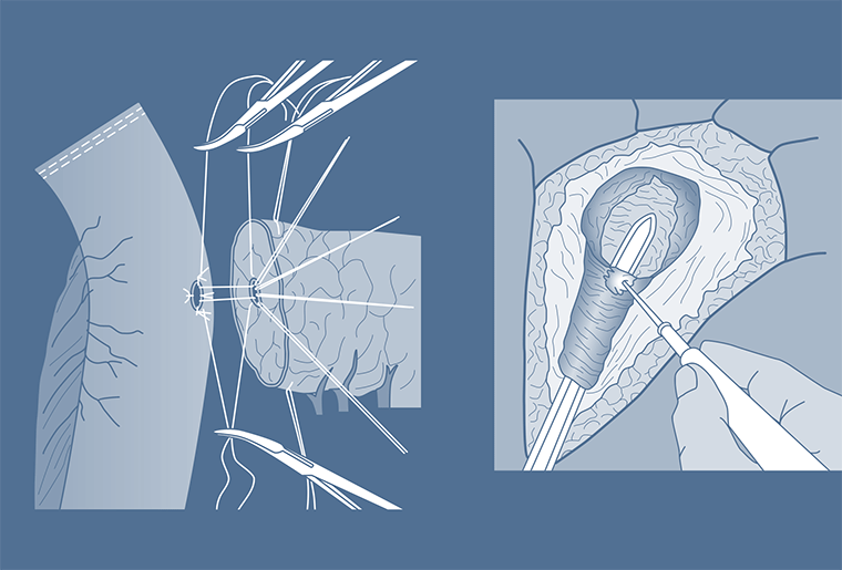 Surgical Process Institute - 6